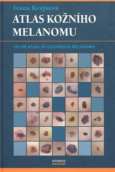 Levně Atlas kožního melanomu - Krajsová Ivana