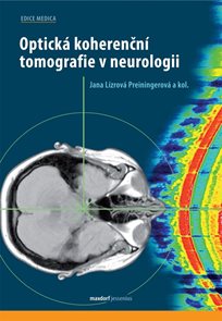 Optick&#225; koherenčn&#237; tomografie v neurologii
