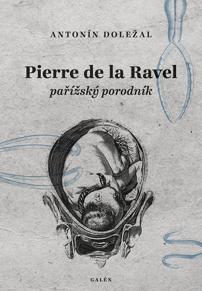 Pierre de la Ravel, pařížský porodník - Doležal Antonín