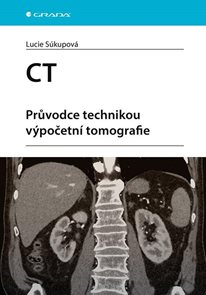 CT - Průvodce technikou v&#253;početn&#237; tomografie