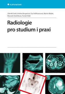 Radiologie pro studium i praxi - Seidl Zdeněk