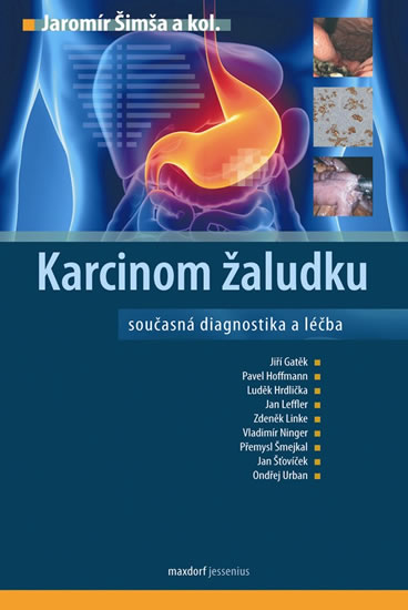 Karcinom žaludku - Šimša Jaromír a kolektiv - 16,3x23,6